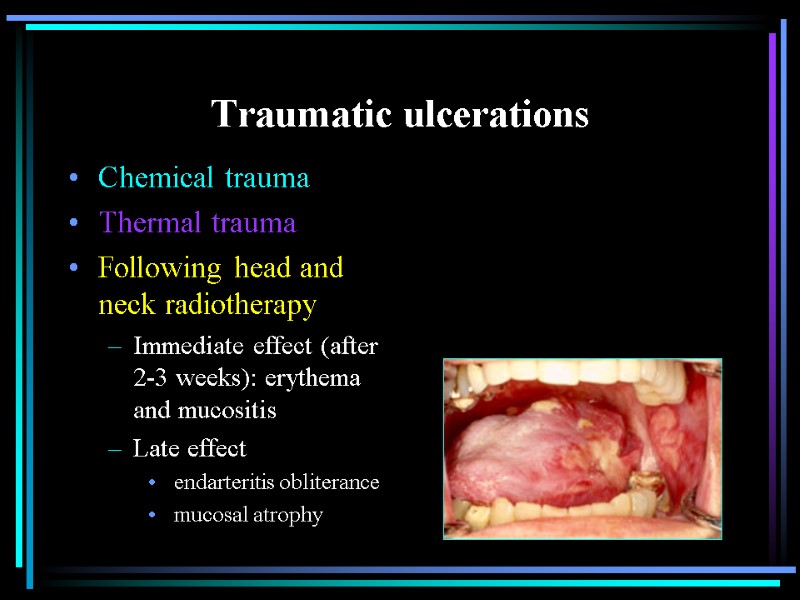 Traumatic ulcerations Chemical trauma Thermal trauma Following head and neck radiotherapy Immediate effect (after